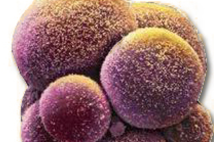 Őssejt-terápiával kezelhető a stroke